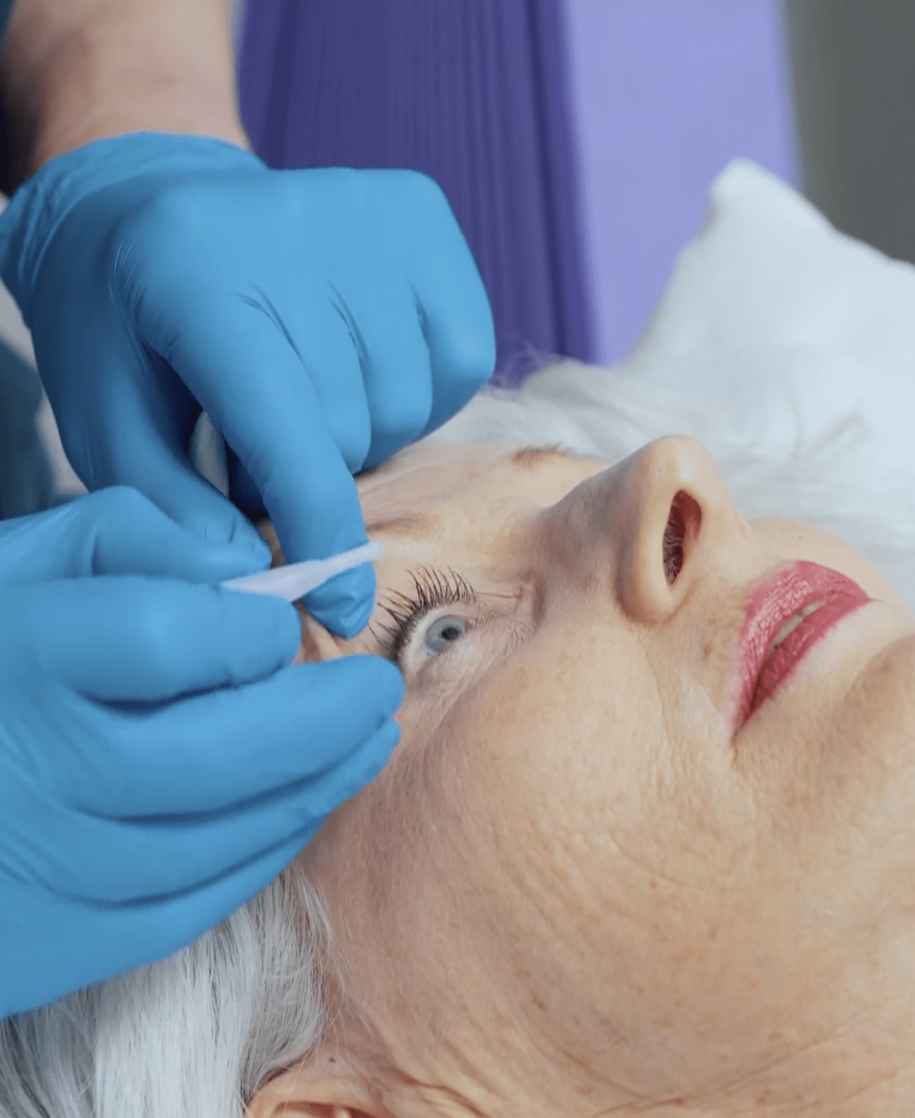 AMD injection treatment in a clean-room theatre
